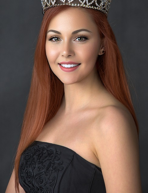 许多欧洲顶 许多欧洲顶